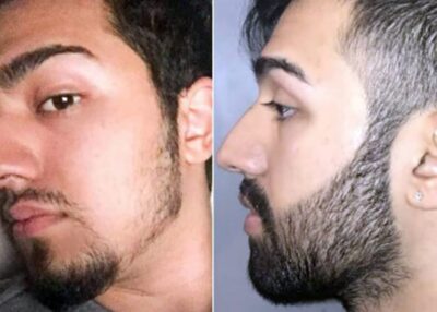 MINOXIDIL KIRKLAND CAJA X 6 UNIDADES DE 60 ML - Image 4